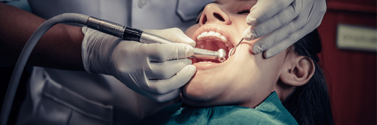 Root Canal Therapy (RCT)