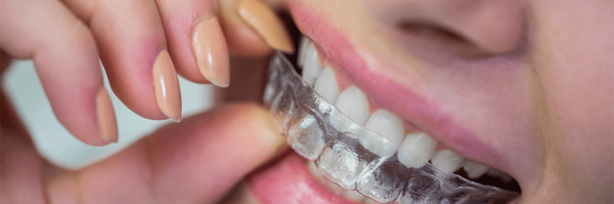 Fix Teeth