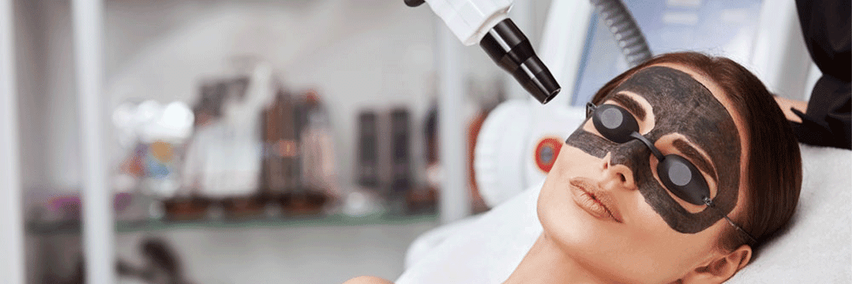 Carbon Peel Laser Treatment
