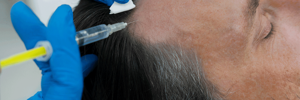 Hair Growth Treatment